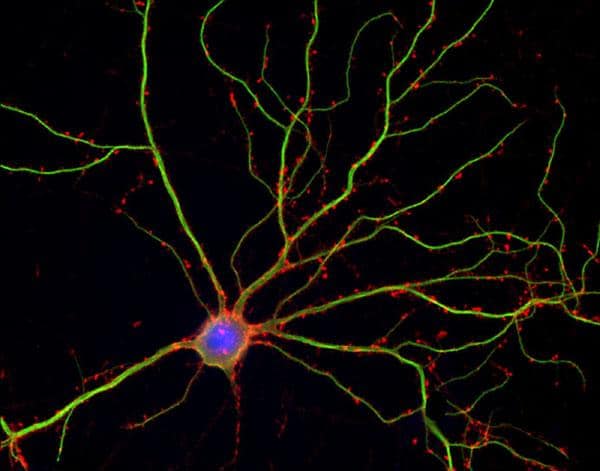 Neuron with dendritic spines