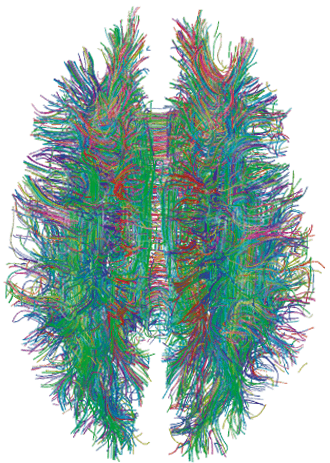 White_Matter_Connections_Obtained_with_MRI_Tractography